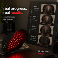 Pro Red Light Hair Growth Cap | Lumisca — Hair Regrowth at Home